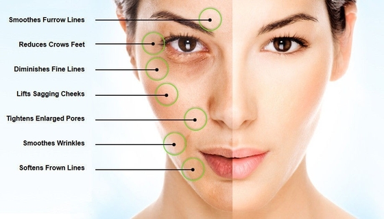 Ο σταυρός σύνδεσε τη Hyaluronic όξινη σκόνη χαμηλή - μοριακό βάρος 98%